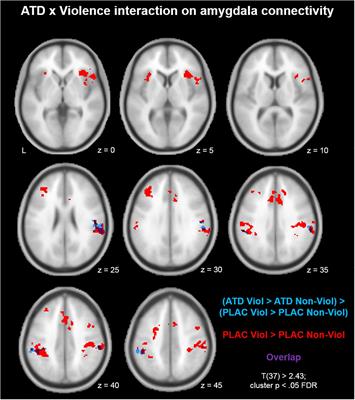 Serotonergic Contributions to Human Brain Aggression Networks